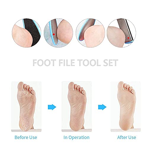 MAPPERZ 8 in 1 Pedicure Tool Kit for Feet Foot Scrubber for Dead Skin, Callus Remover, Foot Scraper, Foot File, Pitchfork, Filer for Nail Repair tool - Set of 1