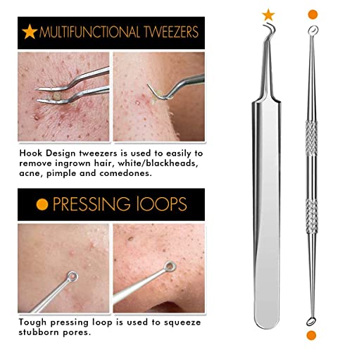 MAPPERZ 5 in 1 Stainless Steel Blackhead Remover Tool Kit with Case/Anti Slip Blackhead Tweezers Pimple Removal Tool Acne Needle Set