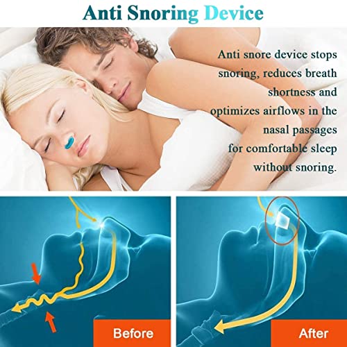 MAPPERZ Nose Snoring Relief Nasal Strips/Nose Strips for Snoring/Anti Snoring Device for Men Women