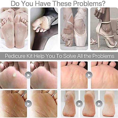 MAPPERZ 8 in 1 Pedicure Tool Kit for Feet Foot Scrubber for Dead Skin, Callus Remover, Foot Scraper, Foot File, Pitchfork, Filer for Nail Repair tool - Set of 1