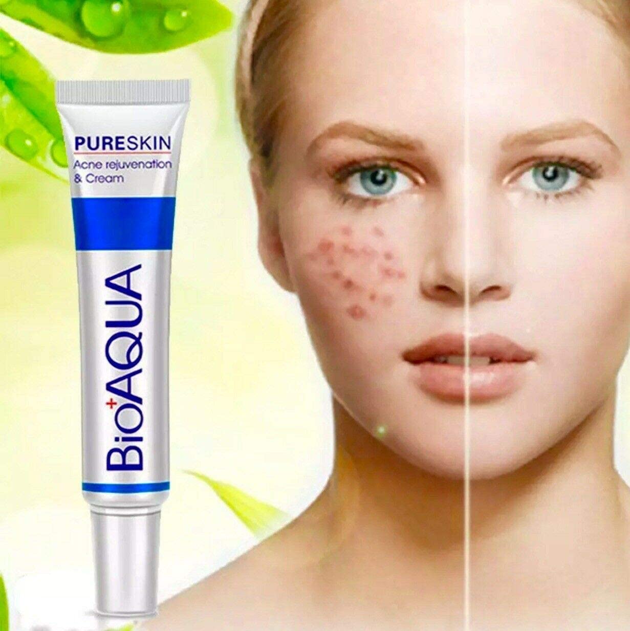 MAPPERZ | AquaBioaqua Face Care Acne Treatment Acne Treatment Cream Shrink Pores Oil Control Skin Care 30gm