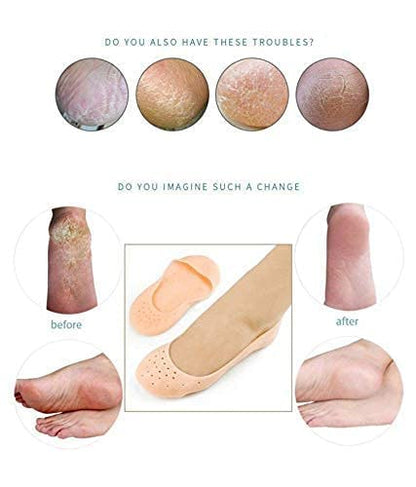 MAPPERZ Full Length Anti Crack Silicone Foot Protector Moisturising Socks for Foot-Care and Heel Cracks/ Socks for Cracked Feet (Full Heel)