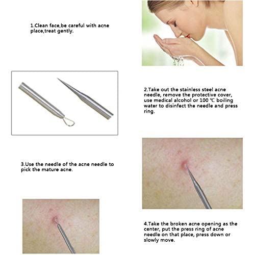 MAPPERZ Blackhead Acne Removal Needle Kit 4 Pcs Cleaning Tool Blemish Pimple Comedone for Women and Men Blackhead, Blemish, Whitehead Popping, Zit Removing for Risk Free Nose Face Skin with Case -PC1
