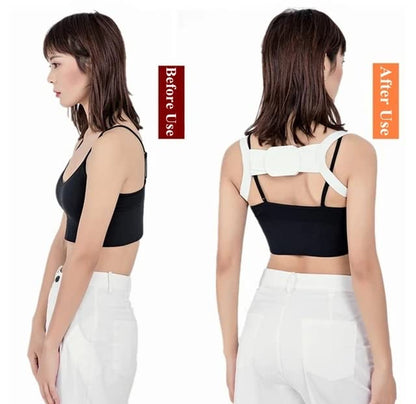 MAPPERZ Back Support Belt for Men And Women Back Shoulder Posture Correction For Back Pain Back Straight And Shoulder Support (Pack of 1)