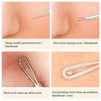 MAPPERZ 5 in 1 Stainless Steel Blackhead Remover Tool Kit with Case/Anti Slip Blackhead Tweezers Pimple Removal Tool Acne Needle Set