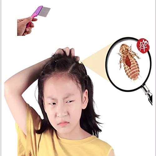 MAPPERZ Lice Treatment Comb for Head Lice with Long Handle/ Nit Lice Egg Removal Stainless steel Long Teeth For Men Women