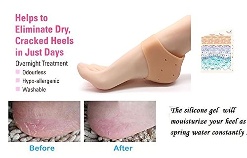 Mapperz Silicone Gel Heel Pad Socks For Heel Swelling Pain Relief,Dry Hard Cracked Heels Repair Cream Foot Care Ankle Support Cushion - For Men And Women - (Free Size Pair)
