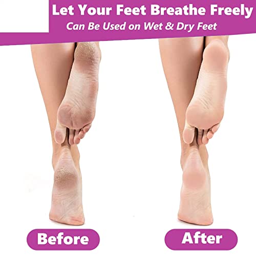 MAPPERZ Stainless Steel Callus Remover Tool Foot Filer Heel Scrubber Foot Scrubber for Dead Skin / Foot Exfoliating Scrubber Cleaner File, Pedicure Foot File (Black)