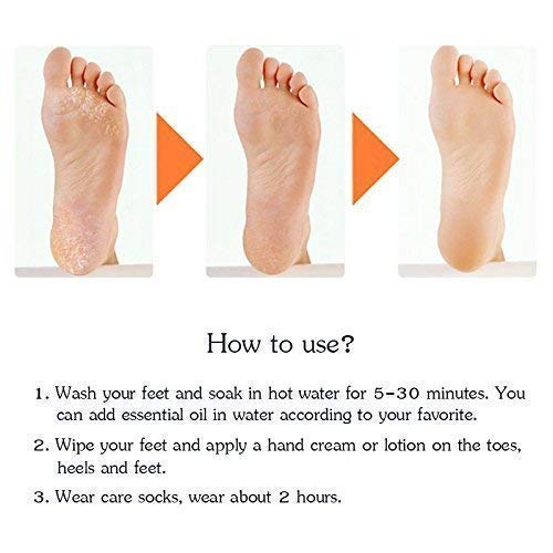 MAPPERZ Full Length Anti Crack Silicone Foot Protector Moisturising Socks for Foot-Care and Heel Cracks/ Socks for Cracked Feet (Full Heel)