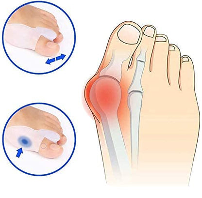 MAPPERZ Gel Big Toe Bunion Guards/Toe Spreaders Bunion Pads Big Toe Separator Cushion Straightener/Gel Toe Spacers, Protectors, Corrector - 1 Pair