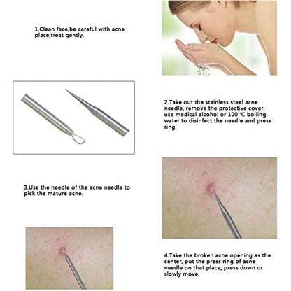 MAPPERZ Blackhead Acne Removal Needle Kit 4 Pcs Cleaning Tool Blemish Pimple Comedone for Women and Men