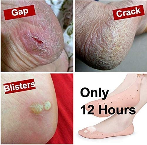 MAPPERZ Full Length Anti Crack Silicone Foot Protector Moisturising Socks for Foot-Care and Heel Cracks/ Socks for Cracked Feet (Full Heel)