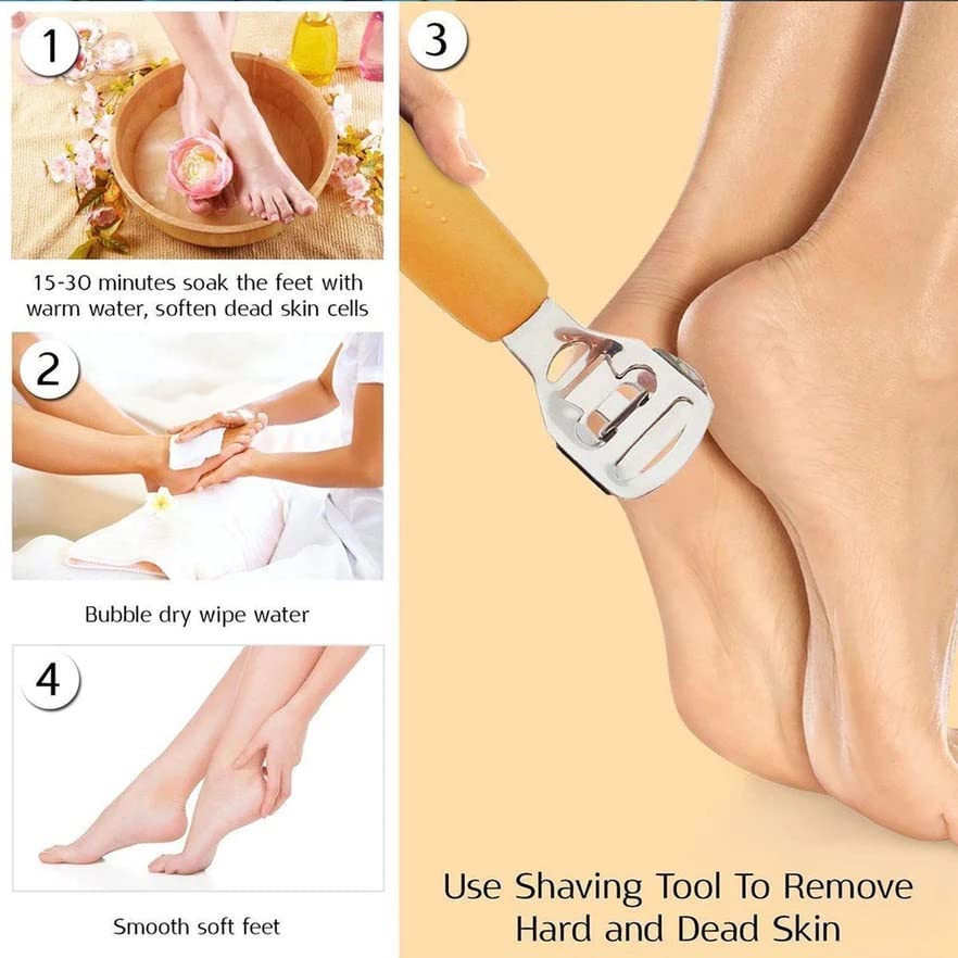 MAPPERZ Foot Care Pedicure Callus Shaver, Dead Hard Skin Remover, Scraper For Hand Feet Heel Care, Hard Dry Skin Remover, Stainless Steel Foot Razor, Foot File Tool, With 1 Blade, Pack Of 1