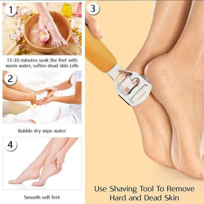 MAPPERZ Foot Care Pedicure Callus Shaver, Dead Hard Skin Remover, Scraper For Hand Feet Heel Care, Hard Dry Skin Remover, Stainless Steel Foot Razor, Foot File Tool, With 1 Blade, Pack Of 1